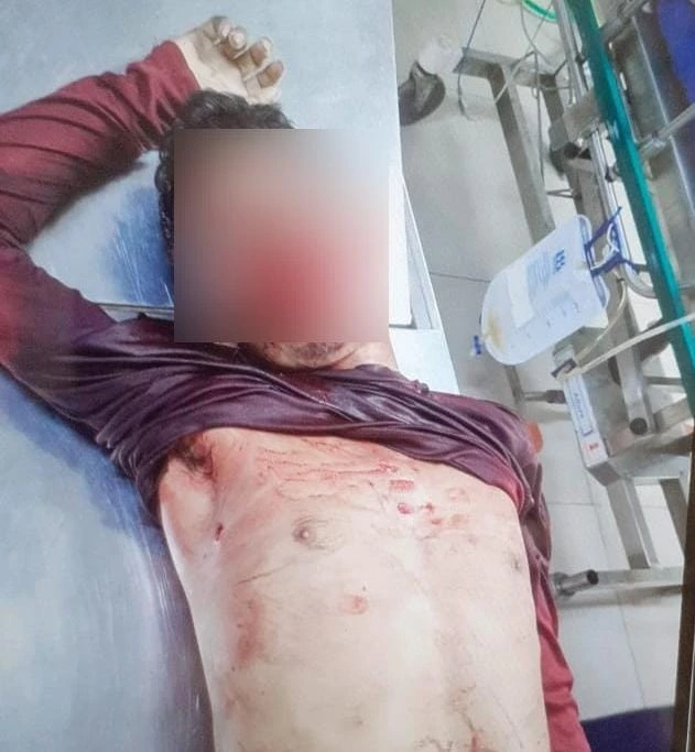 Suspeito de homicídio do motorista de aplicativo morre em confronto com a PMRR