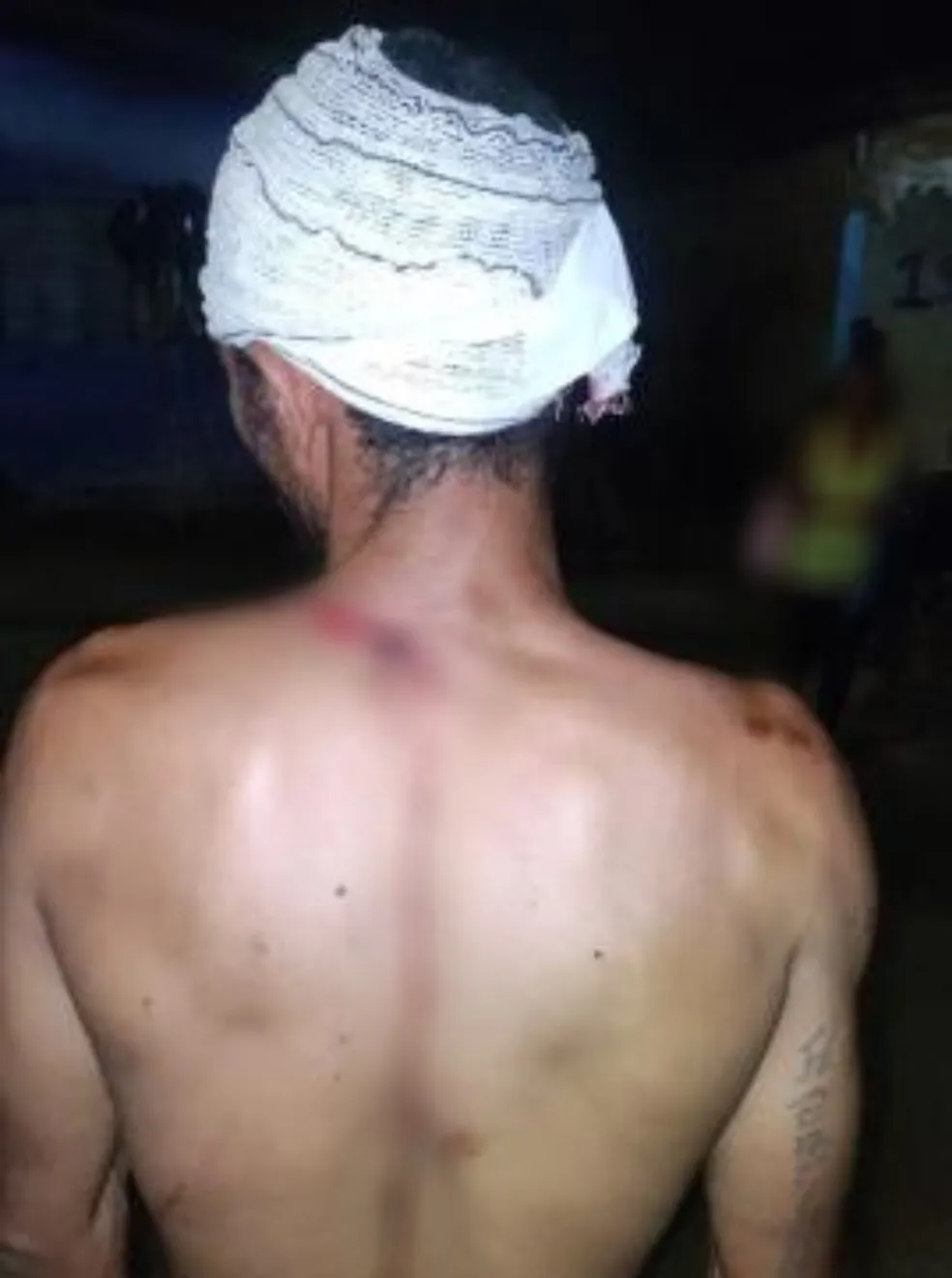  Homem furta galo e é esfaqueado na cabeça, costas e ombros em Boa Vista