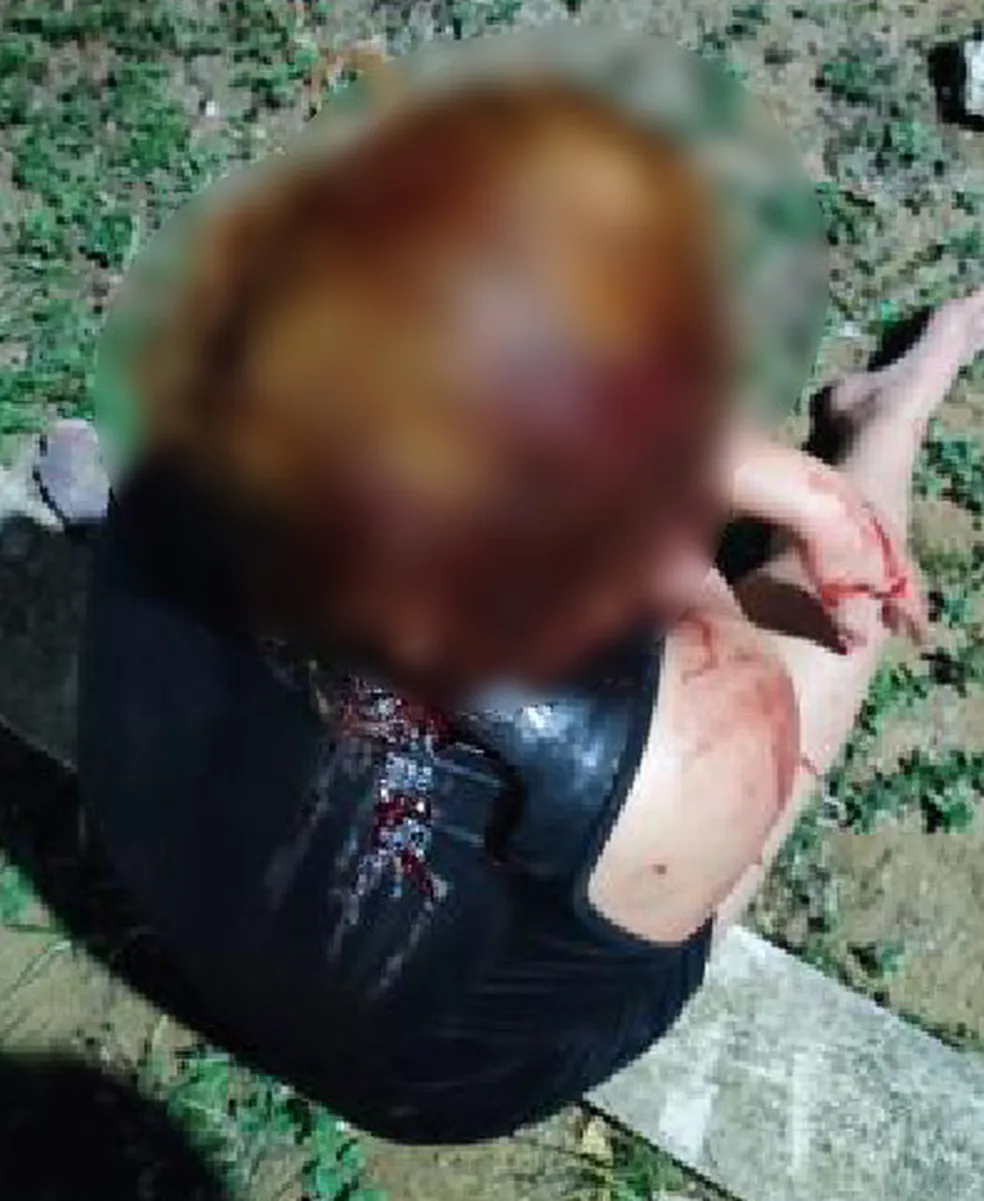 Jovem é agredida na cabeça pelo marido após sair para beber com amiga