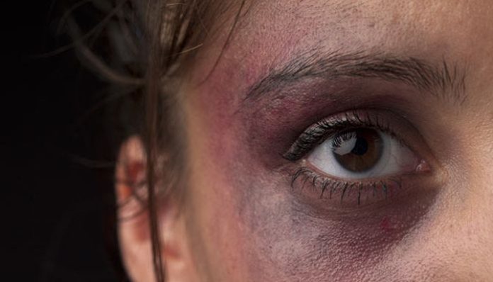 Homem é preso após furar o olho da sua ex-companheira: 'para ela nao enxergar outros homens'